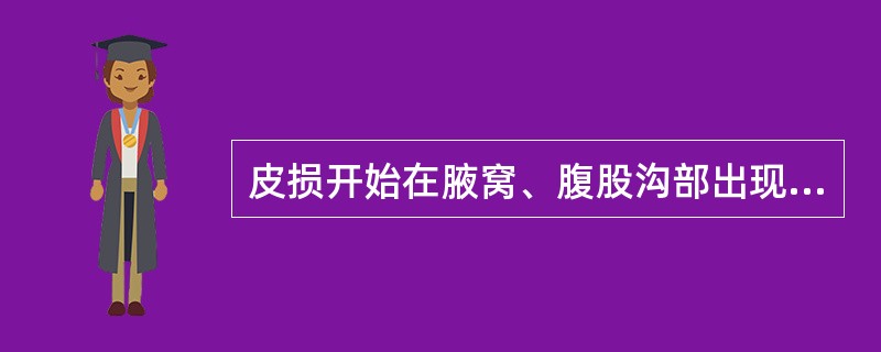 皮损开始在腋窝、腹股沟部出现大片鲜红色或紫红色斑片，自觉灼痛，迅速扩大，表面出现菲薄松弛之大疱的药疹是（）