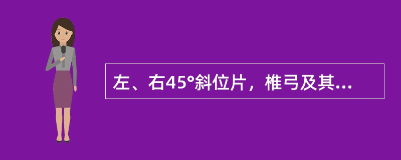 左、右45°斜位片，椎弓及其附件投影似“狗”形，峡部裂时似狗颈戴项链，椎板为（　）。