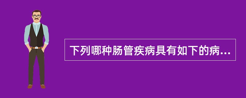 下列哪种肠管疾病具有如下的病变：溃疡边缘不整，其长轴与肠轴垂直，溃疡底部附有干酪样坏死物