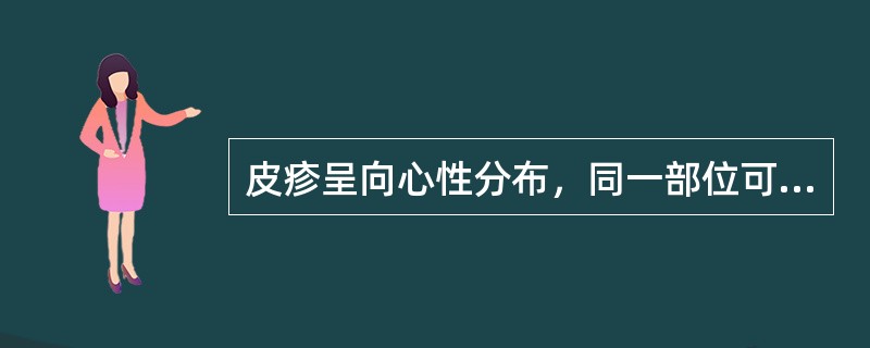 皮疹呈向心性分布，同一部位可见不同性状皮疹的是