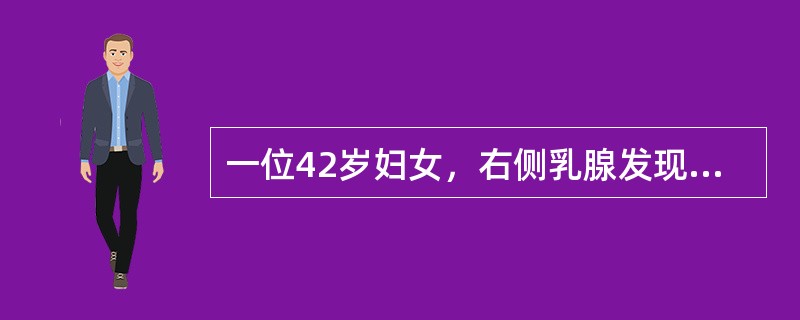 一位42岁妇女，右侧乳腺发现一无痛性肿块，生长速度快，质硬，分界不清，同侧腋窝淋巴结肿大。应考虑