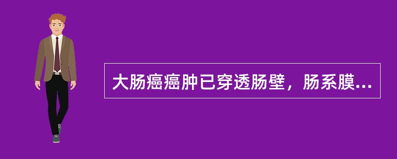 大肠癌癌肿已穿透肠壁，肠系膜根部淋巴结肿大，在Dukes分期中属于