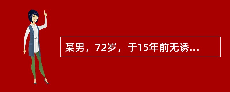 某男，72岁，于15年前无诱因出现多饮多尿，伴体重减轻，常规检查发现血糖升高，未予重视，4年前发现血压升高，最高180/100mmHg，1年前双下肢间断水肿。6年前出现双眼视力减退，视物模糊，无发热发