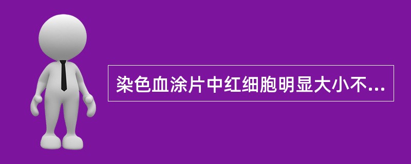 染色血涂片中红细胞明显大小不等，相差悬殊，见于