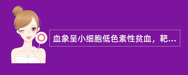 血象呈小细胞低色素性贫血，靶形细胞占30%，网织红细胞20%，HbF80%。骨髓红系增生亢进，细胞内外铁增多，脆性试验显著降低。这最有可能是