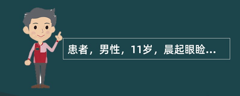 患者，男性，11岁，晨起眼睑水肿，血尿、少尿1周。血压185／105mmHg，既住无肾病史。若血清补体C3及总补体下降，中度尿蛋白并见颗粒管型。患者最可能的诊断是