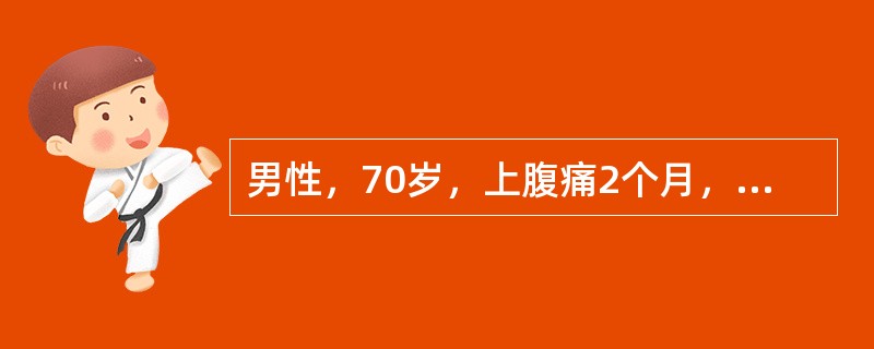 男性，70岁，上腹痛2个月，胃镜检查提示十二指肠球部溃疡。既往青光眼5年（　　）。