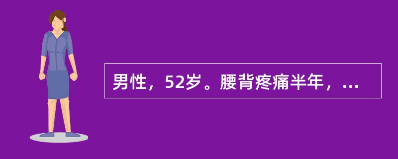 男性，52岁。腰背疼痛半年，牙龈出血2周就诊。体检：中度贫血貌，肝肋下1cm，脾肋下刚及。化验：Hb80g/L，WBC3.8×109/L，血小板56×109/L。尿蛋白（＋＋＋），ESR105mm/h