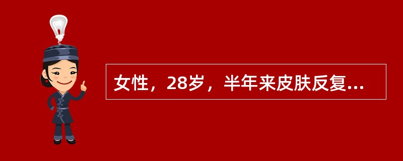 女性，28岁，半年来皮肤反复出现紫癜来诊。查体：巩膜无黄染，胸骨无压痛，肝脾未触及。血红蛋白100g/L，白细胞3.8×109/L，分类淋巴细胞占60％，中性粒细胞40％，血小板40×109/L，粒系