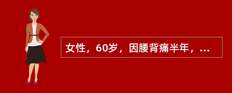 女性，60岁，因腰背痛半年，胸痛2个月来诊，胸腰椎及肋骨X线片显示胸12和腰1椎体呈楔形骨折，肋骨多处溶骨性破坏，化验血Hb80g／L，ESR104mm／第1小时末，尿蛋白(++)和尿本-周蛋白(-)
