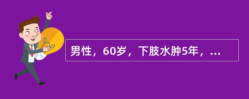 男性，60岁，下肢水肿5年，右下肢水肿较剧，无高血压和糖尿病病史。昨晚在看电视时突惑呼吸困难，活动后加重，不伴咳嗽、咳痰，其可能的诊断为（　　）。