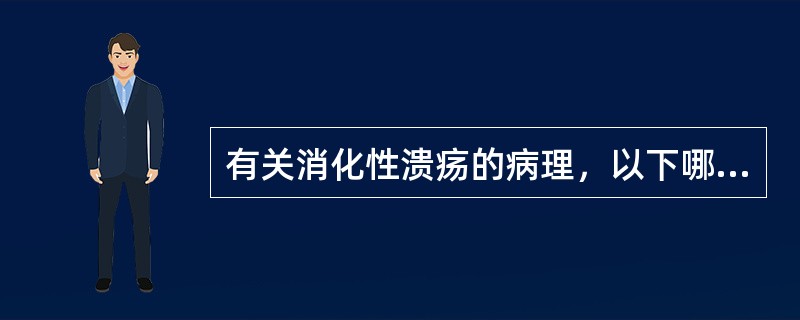 有关消化性溃疡的病理，以下哪种不正确