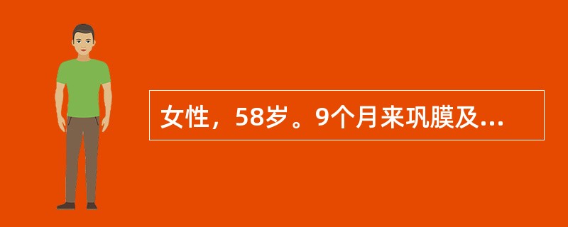 女性，58岁。9个月来巩膜及皮肤发黄，伴皮肤瘙痒来诊。体检：巩膜及皮肤明显黄染，肝肋下4cm，质硬无压痛，脾肋下5cm，考虑为原发性胆汁性肝硬化。原发性胆汁性肝硬化的主要病变在