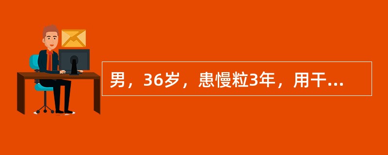 男，36岁，患慢粒3年，用干扰素治疗，效果较好。近期出现乏力、低热、盗汗，脾肋下4cm，血红蛋白70g/L。应首先考虑的诊断（　　）。