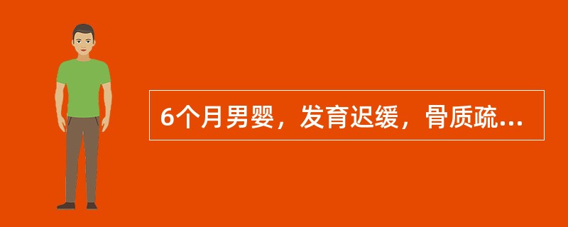 6个月男婴，发育迟缓，骨质疏松，全身皮肤苍白、黄染，肝脾大。检验：HGB60g/L，WBC6.8×109/L，PLT100×109/L，HGBF＞80％，Coombs试验阴性，血片可见靶形细胞，红细胞