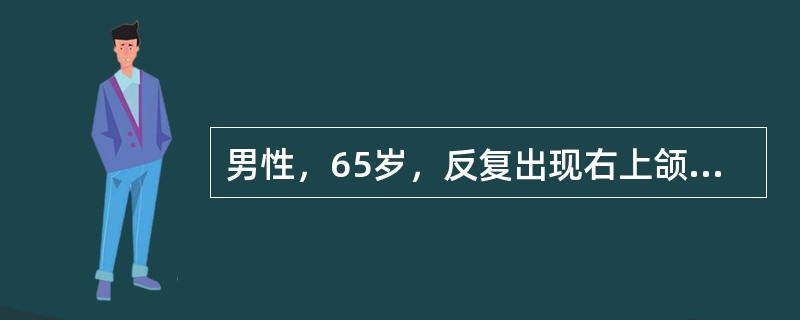 男性，65岁，反复出现右上颌部疼痛不适，呈闪电样、针刺样疼痛，每次发作持续数秒，进食时频繁，间歇期正常。此患者最可能诊断为（　　）。