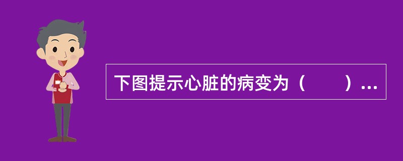 下图提示心脏的病变为（　　）。<br /><img src="https://img.zhaotiba.com/fujian/20220820/nce52eylen5.pn