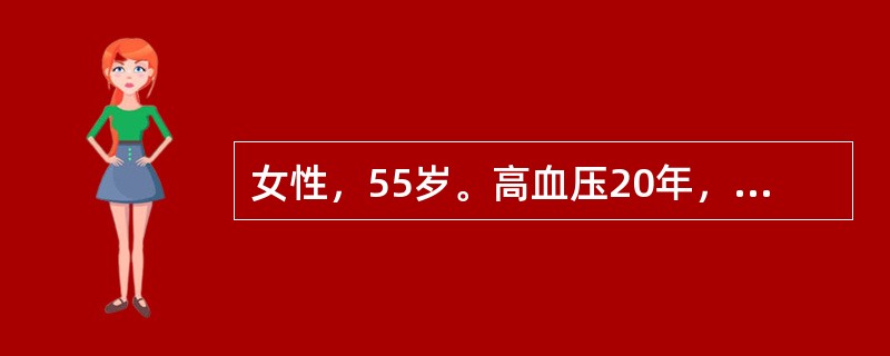 女性，55岁。高血压20年，不规律服药，某日晨起突发头痛，意识不清，30分钟后送到医院。体检：昏迷，血压210/120mmHg，双眼向右侧凝视，左足外旋位。<p>最可能的诊断是（　　）。