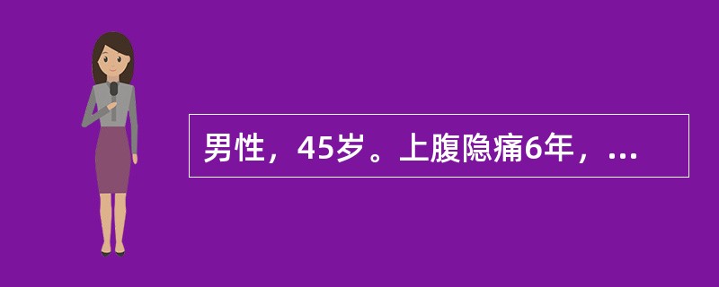 男性，45岁。上腹隐痛6年，为空腹时疼痛，进餐后可缓解。1年前患者行胃肠钡透提示十二指肠球部变形。2天前因大量进食后出现上腹疼痛加重，疼痛可向腰背部放射。查体：上腹部压痛、反跳痛及肌紧张。急查血常规提