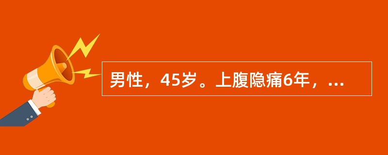 男性，45岁。上腹隐痛6年，为空腹时疼痛，进餐后可缓解。1年前患者行胃肠钡透提示十二指肠球部变形。2天前因大量进食后出现上腹疼痛加重，疼痛可向腰背部放射。查体：上腹部压痛、反跳痛及肌紧张。急查血常规提