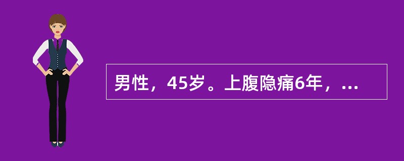 男性，45岁。上腹隐痛6年，为空腹时疼痛，进餐后可缓解。1年前患者行胃肠钡透提示十二指肠球部变形。2天前因大量进食后出现上腹疼痛加重，疼痛可向腰背部放射。查体：上腹部压痛、反跳痛及肌紧张。急查血常规提