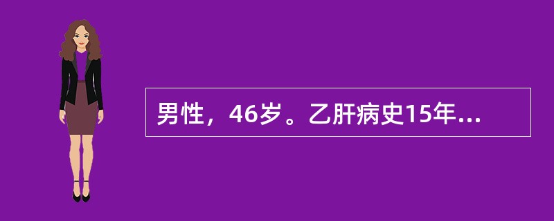 男性，46岁。乙肝病史15年，2年来出现乏力，腹胀，尿量减少，偶有牙出血和鼻出血。1天前，劳累后突然出现恶心，呕新鲜血含有血块，共约1000ml。查体：P110次/分，神志淡漠。最可能的诊断为