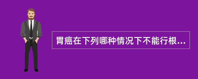 胃癌在下列哪种情况下不能行根治性手术