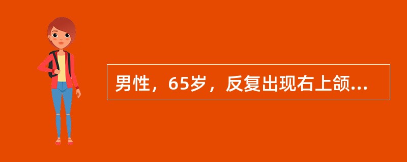 男性，65岁，反复出现右上颌部疼痛不适，呈闪电样、针刺样疼痛，每次发作持续数秒，进食时频繁，间歇期正常。此患者最可能诊断为（　　）。