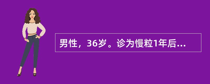 男性，36岁。诊为慢粒1年后出现发热、出血，贫血加重，脾肋下5cm，骨髓检查：原淋占90％，POX染色阴性最可能的诊断是（　　）。