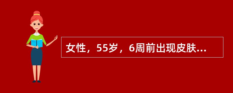 女性，55岁，6周前出现皮肤巩膜黄染，4周前黄疸消退后又逐渐加重，间断排灰白色和黑色粪便，无腹痛、发热和消瘦。查体：右侧肋下可触及一肿物的边缘，表面光滑、呈囊性，肝剑突下3cm可及。大便隐血（＋）。患