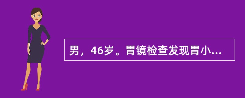 男，46岁。胃镜检查发现胃小弯侧2cm×0cm浅表溃疡，病理诊断为腺癌。手术切除标本病理示病变累及黏膜层及黏膜下层，小弯侧有2个淋巴结转移。应诊断为（　　）。