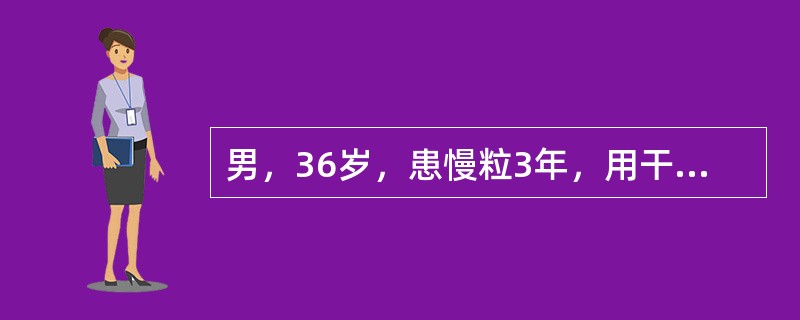 男，36岁，患慢粒3年，用干扰素治疗，效果较好。近期出现乏力、低热、盗汗，脾肋下4cm，血红蛋白70g/L。应首先考虑的诊断（　　）。