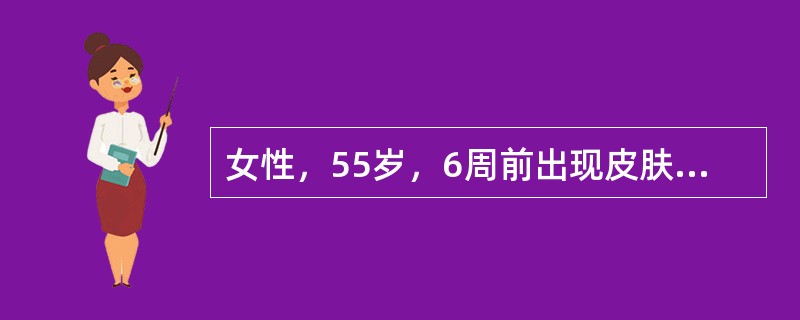 女性，55岁，6周前出现皮肤巩膜黄染，4周前黄疸消退后又逐渐加重，间断排灰白色和黑色粪便，无腹痛、发热和消瘦。查体：右侧肋下可触及一肿物的边缘，表面光滑、呈囊性，肝剑突下3cm可及。大便隐血（＋）。患