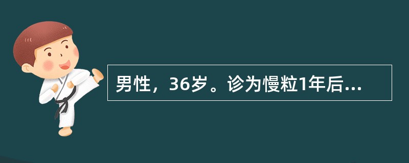 男性，36岁。诊为慢粒1年后出现发热、出血，贫血加重，脾肋下5cm，骨髓检查：原淋占90％，POX染色阴性最可能的诊断是（　　）。