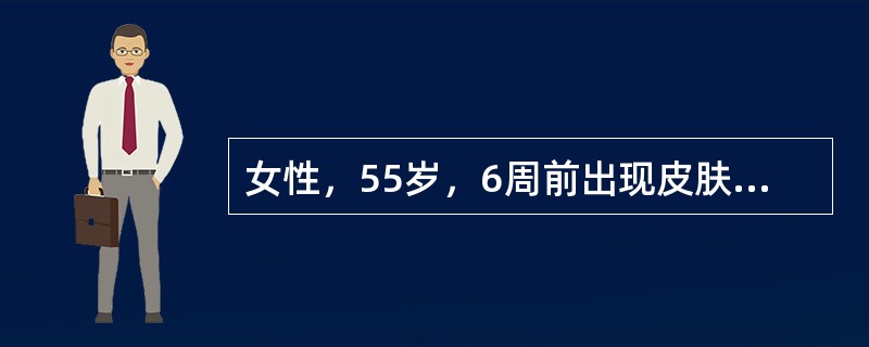 女性，55岁，6周前出现皮肤巩膜黄染，4周前黄疸消退后又逐渐加重，间断排灰白色和黑色粪便，无腹痛、发热和消瘦。查体：右侧肋下可触及一肿物的边缘，表面光滑、呈囊性，肝剑突下3cm可及。大便隐血（＋）。患