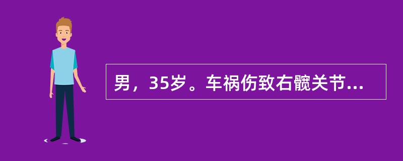 男，35岁。车祸伤致右髋关节痉疼痛，活动不能3天就诊，经检查诊断为右髋关节后脱位