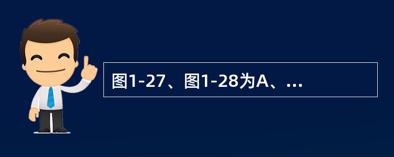 图1-27、图1-28为A、B两个住宅规划方案。A小区用地面积21公顷，可住居民