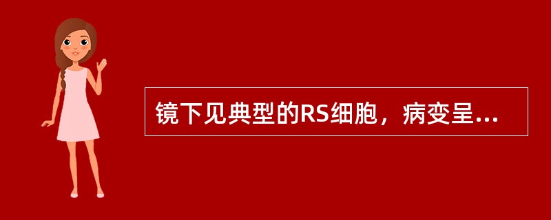 镜下见典型的RS细胞，病变呈弥漫性（）