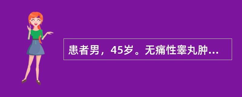 患者男，45岁。无痛性睾丸肿大3个月。血清b-HCG升高，AFP正常。关于精原细