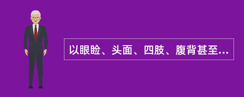 以眼睑、头面、四肢、腹背甚至全身浮肿为临床特征的病证是（）。