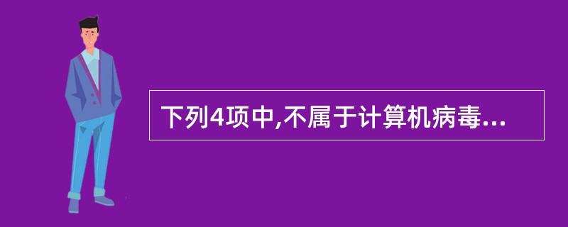 下列4项中,不属于计算机病毒特征的是