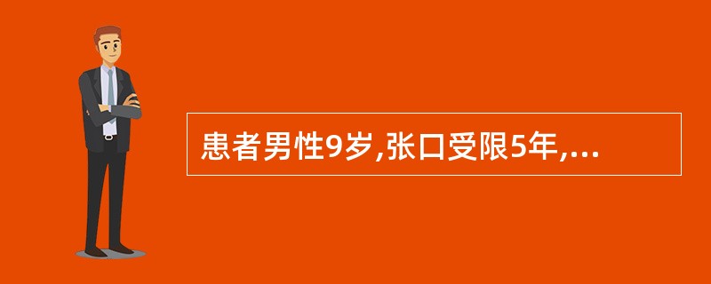 患者男性9岁,张口受限5年,查张口度约2mm,前牙呈扇形,右侧面颊丰满,左侧面颊