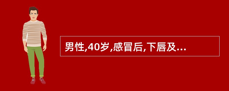 男性,40岁,感冒后,下唇及唇周皮肤出现成簇的针头大小的小水疱,破溃后结痂,局邹