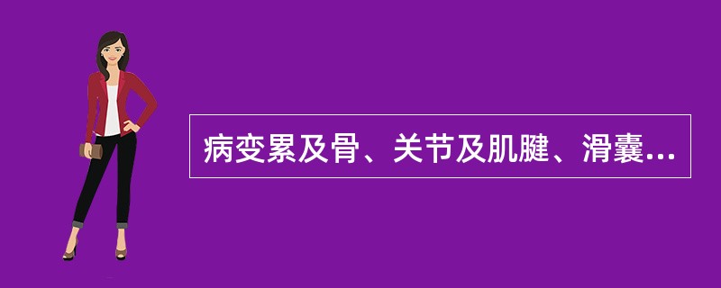 病变累及骨、关节及肌腱、滑囊、筋膜等周围软组织的一组疾病是