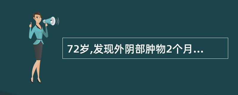 72岁,发现外阴部肿物2个月,肿物生长快,伴有少量出血。查体阴蒂肿大,直径3cm