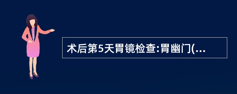 术后第5天胃镜检查:胃幽门(胃窦、体交界处)处2cm×1.5cm不规则形溃疡,取