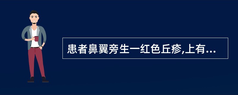 患者鼻翼旁生一红色丘疹,上有粟粒样脓点,灼热疼痛明显,并伴有痒麻感,触之根深坚硬