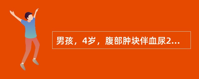 男孩，4岁，腹部肿块伴血尿2个月入院，查体：发现右上腹球状肿块，静脉肾盂造影右肾不显影，考虑诊断（　　）。