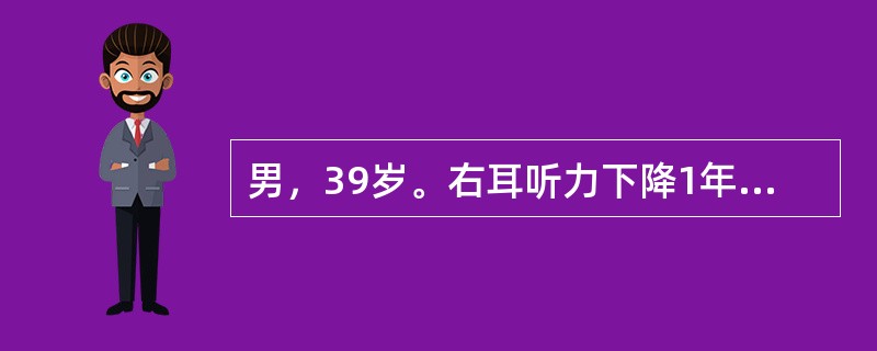 男，39岁。右耳听力下降1年。CT示右侧小脑脑桥角区类圆型占位病变，增强扫描病灶呈均一强化，右侧内听道扩大。诊断考虑（　　）。