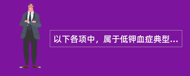 以下各项中，属于低钾血症典型EKG改变的是